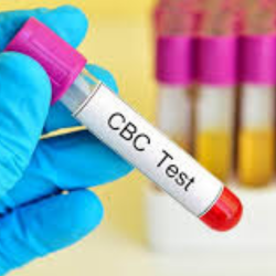 CBC (Complete Blood Count)