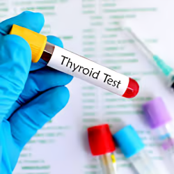 Thyroid Profile Total (T3, T4 & TSH)