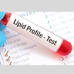 Lipid Profile, Non Fasting