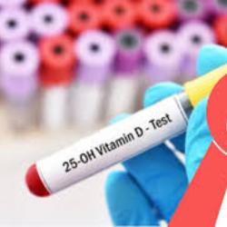 Vitamin D (25-Hydroxy)